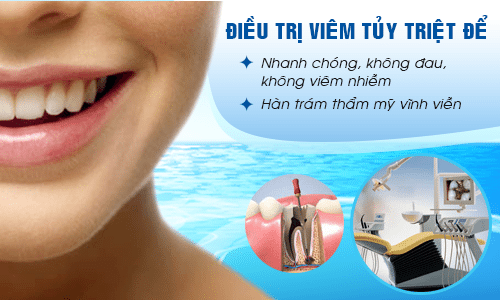 Điều trị tủy răng vĩnh viễn